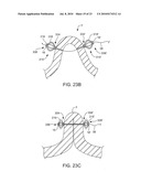 COMPRESSIBLE TISSUE ANCHOR ASSEMBLIES diagram and image