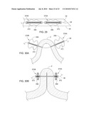 COMPRESSIBLE TISSUE ANCHOR ASSEMBLIES diagram and image