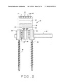 DEVICE FOR SPINAL FUSION diagram and image