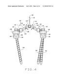 DEVICE FOR SPINAL FUSION diagram and image