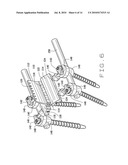 DEVICE FOR SPINAL FUSION diagram and image