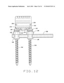 DEVICE FOR SPINAL FUSION diagram and image