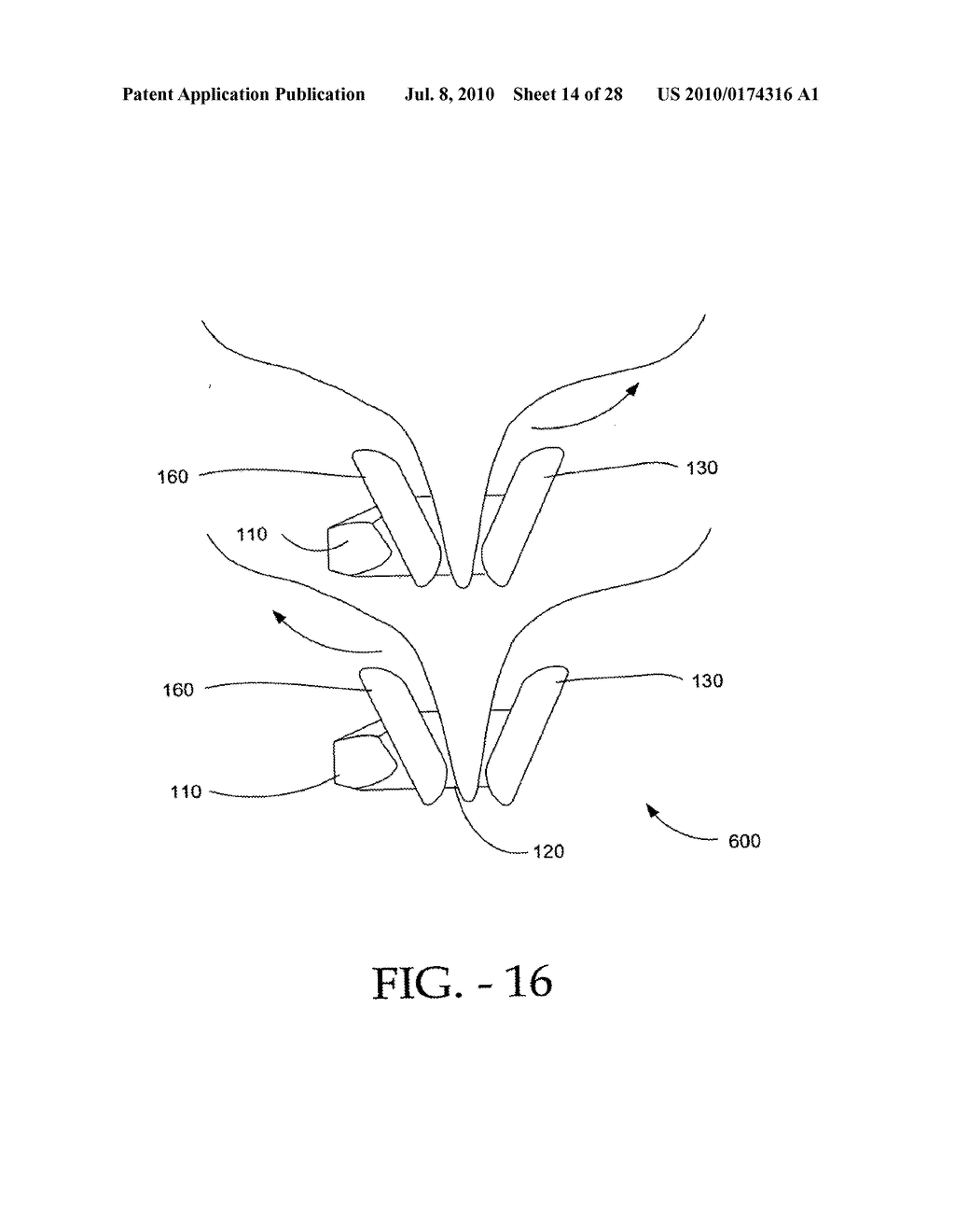 DISTRACTIBLE INTERSPINOUS PROCESS IMPLANT AND METHOD OF IMPLANTATION - diagram, schematic, and image 15