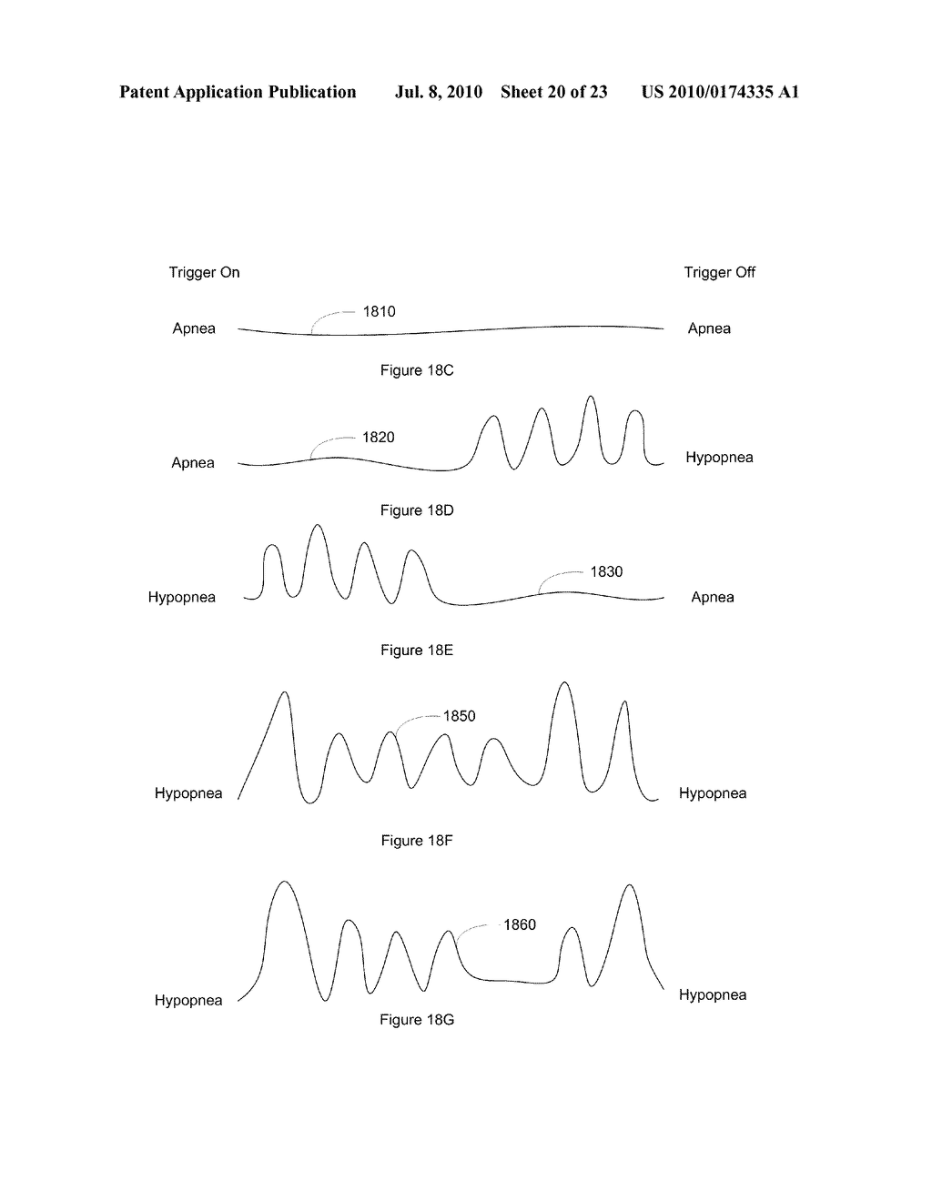 Therapy Triggered by Predication of Disordered Breathing - diagram, schematic, and image 21