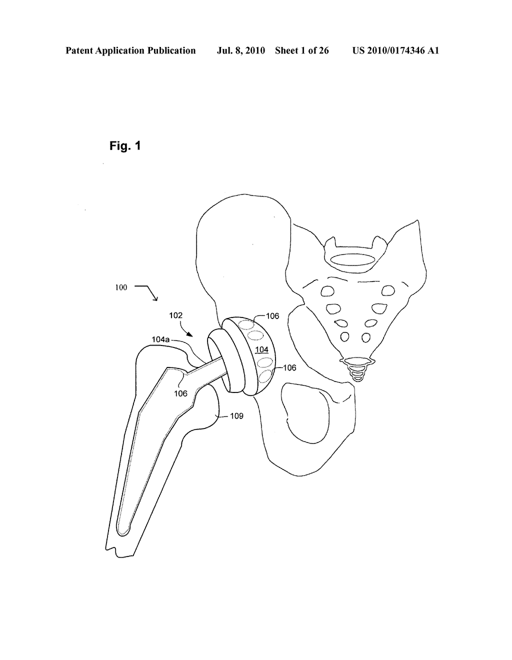 System, devices, and methods including actively-controllable sterilizing excitation delivery implants - diagram, schematic, and image 02