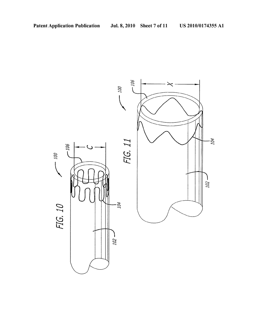 DELIVERY AND RECOVERY SHEATHS FOR MEDICAL DEVICES - diagram, schematic, and image 08