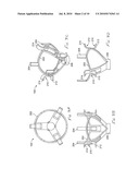 One Piece Prosthetic Valve Support Structure and Related Assemblies diagram and image