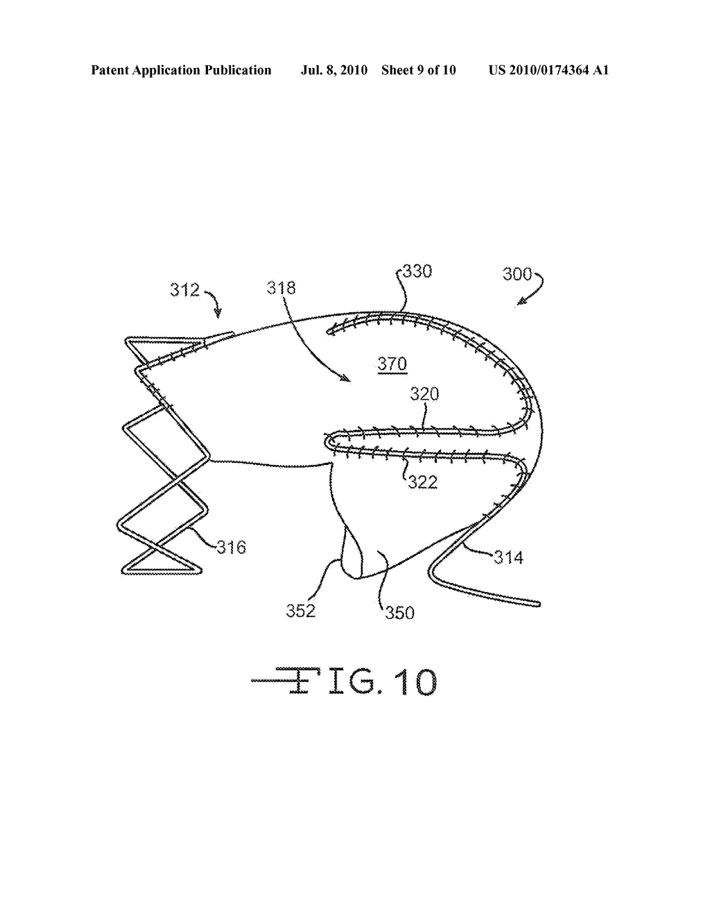 IMPLANTABLE VALVE PROSTHESIS WITH INDEPENDENT FRAME ELEMENTS - diagram, schematic, and image 10