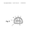 MITRAL ANNULOPLASTY RING diagram and image