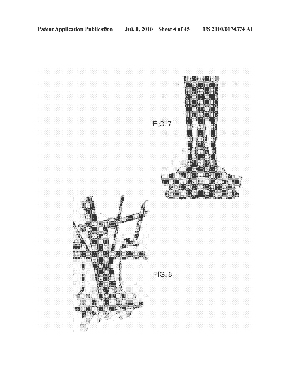 DYNAMIC SPINAL IMPLANTS INCORPORATING CARTILAGE BEARING GRAFT MATERIAL - diagram, schematic, and image 05