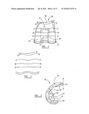 KNEE PROSTHESES diagram and image