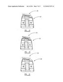 KNEE PROSTHESES diagram and image