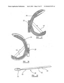 KNEE PROSTHESES diagram and image