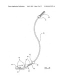 KNEE PROSTHESES diagram and image