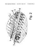 APPARATUS FOR THE REMOVAL OF BOTTLES OR CONTAINERS FROM A BOTTLE OR CONTAINER CLEANING ARRANGEMENT IN A BOTTLE OR CONTAINER FILLING PLANT diagram and image