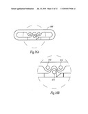 Method Of Forming Metal diagram and image