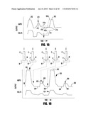 METHOD AND APPARATUS FOR ADAPTIVE GMAW SHORT CIRCUIT FREQUENCY CONTROL AND METHOD OF HIGH DEPOSITION ARC WELDING diagram and image