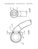 BARRIER diagram and image