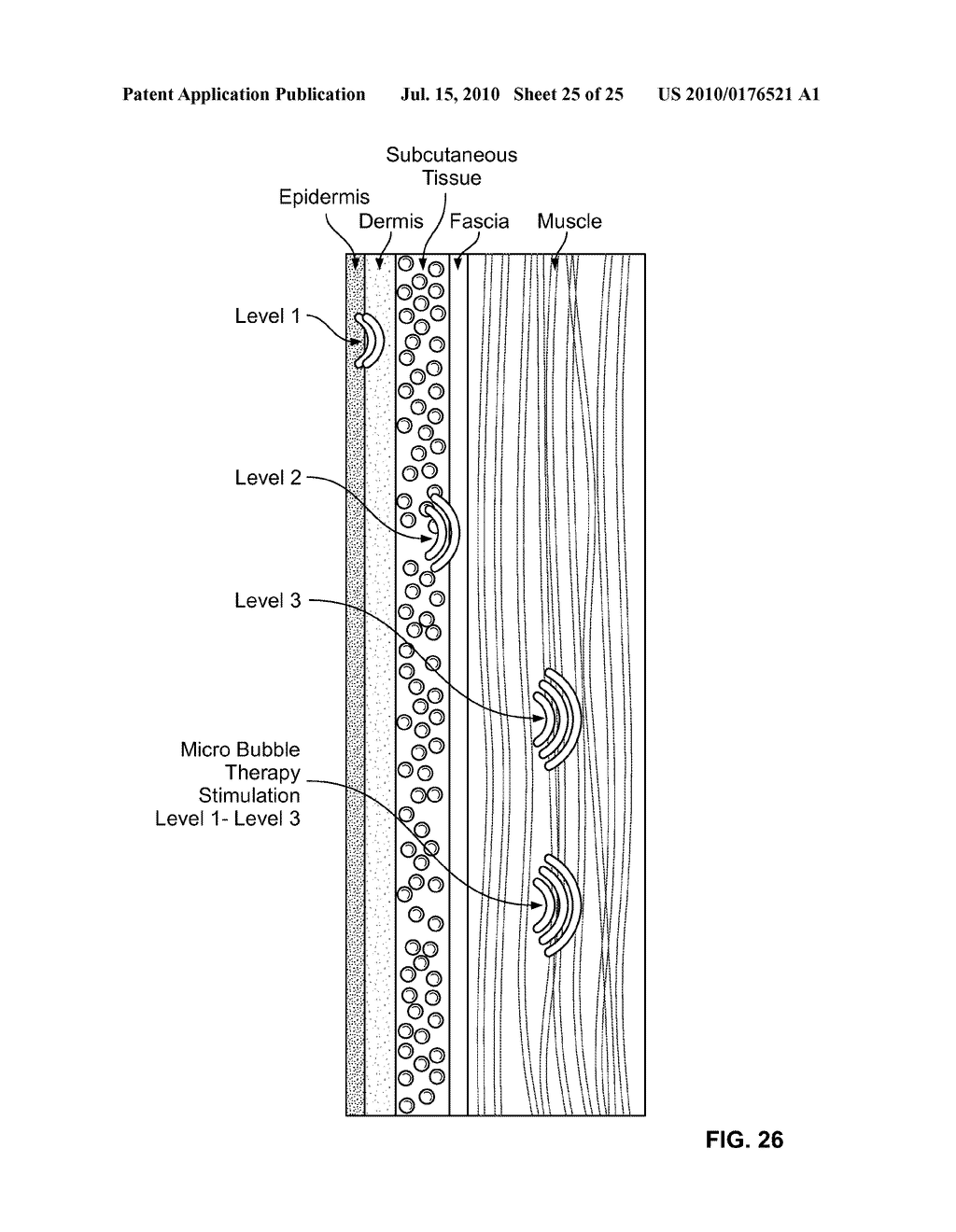 MICROBUBBLE THERAPY METHOD AND GENERATING APPARATUS - diagram, schematic, and image 26