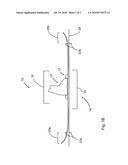 SNOW RIDING IMPLEMENT diagram and image