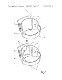 VEIN NAVIGATION DEVICE diagram and image