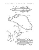 Eyeglass retainer device diagram and image