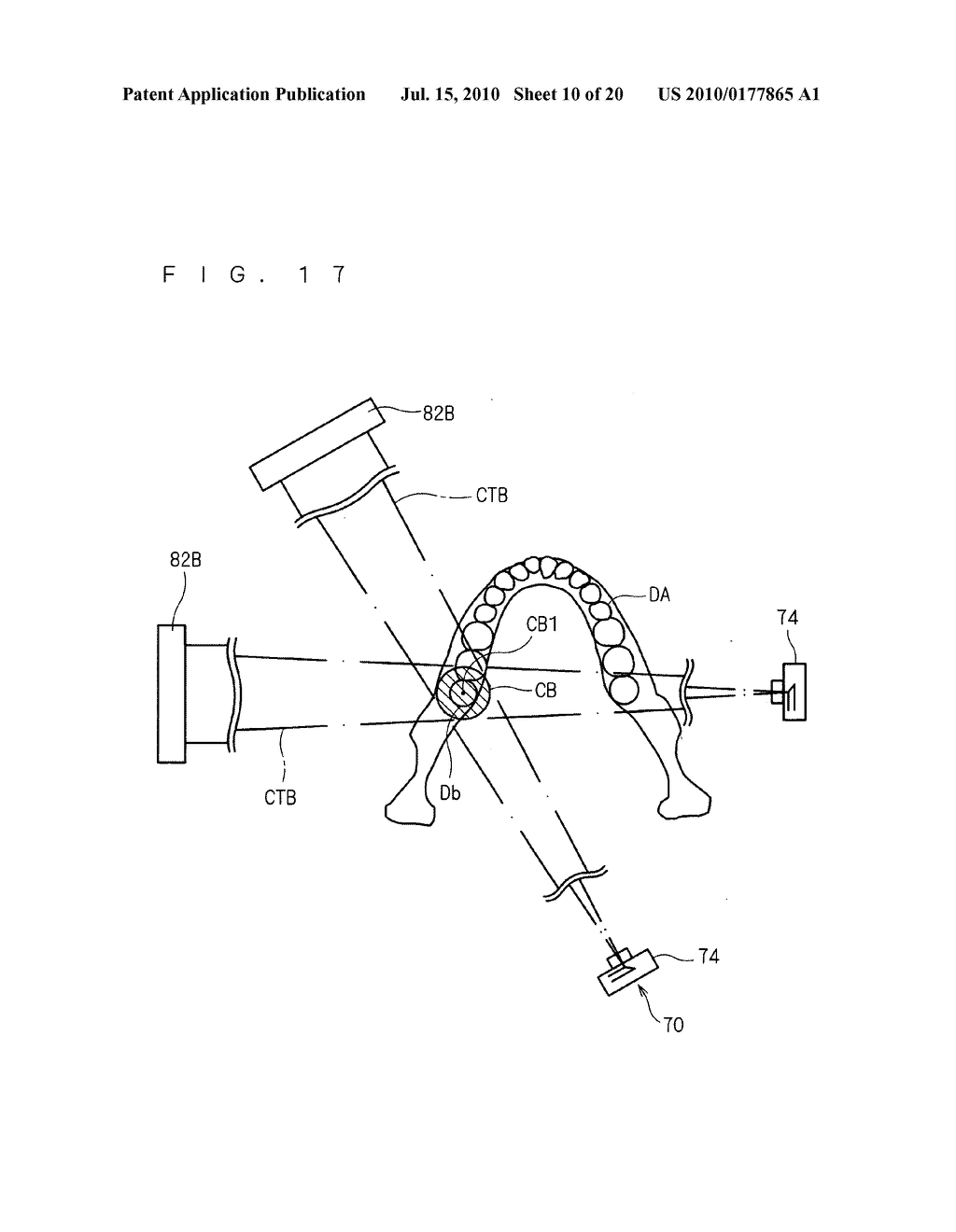 X-ray ct imaging apparatus - diagram, schematic, and image 11