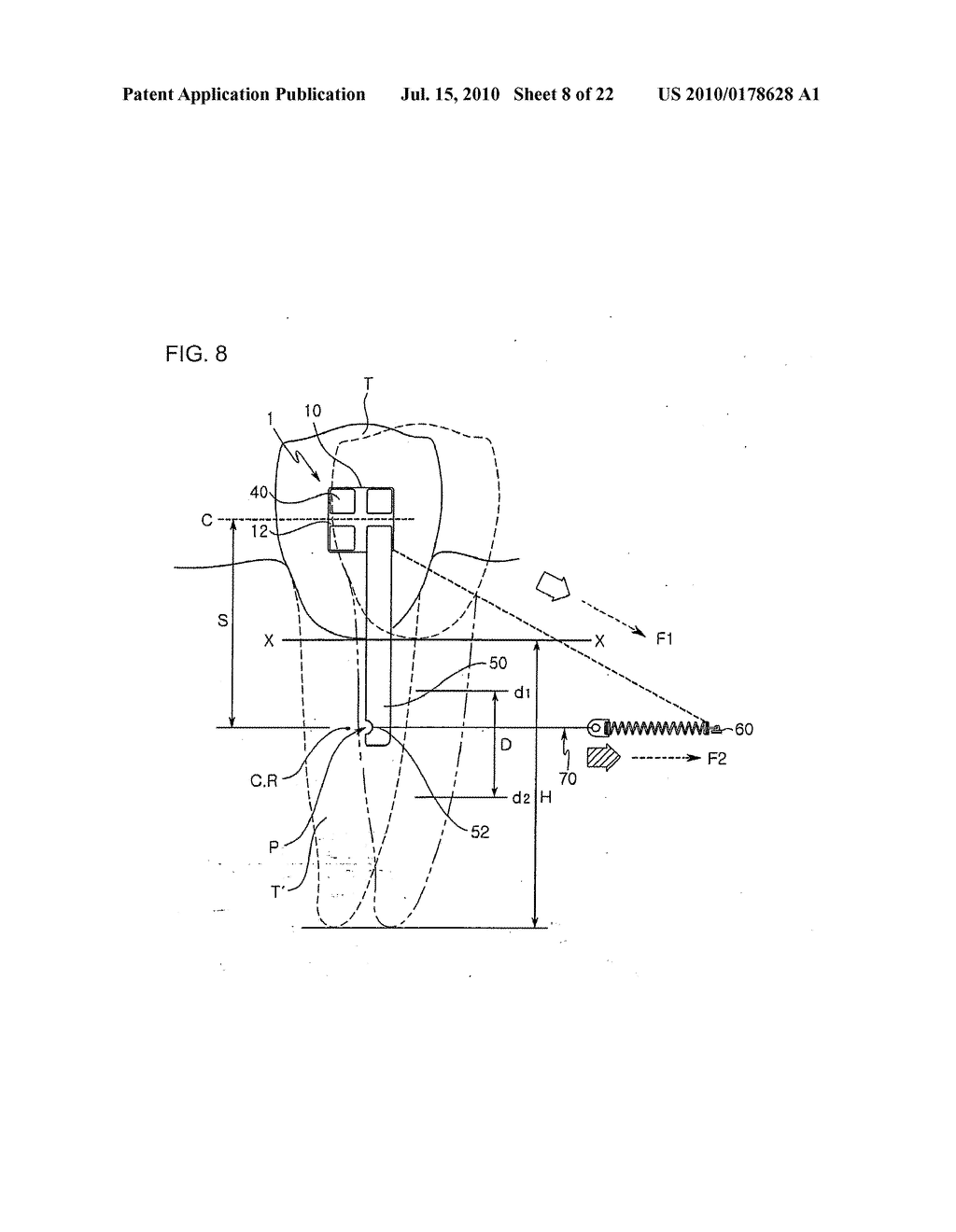 ORTHODONTIC DEVICE AND ORTHODONTIC METHOD - diagram, schematic, and image 09