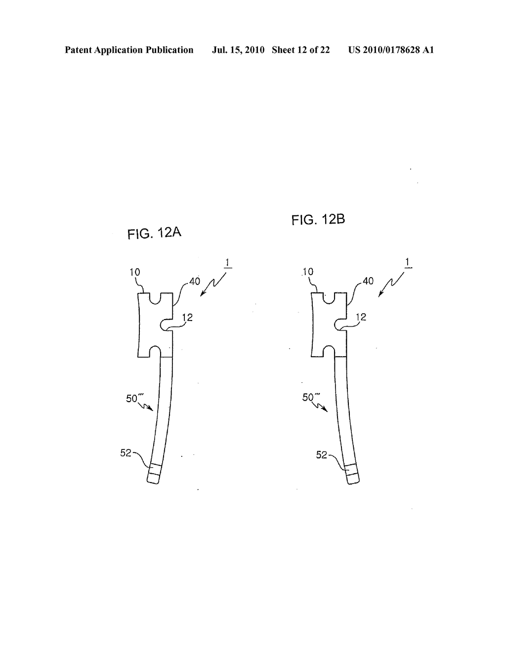 ORTHODONTIC DEVICE AND ORTHODONTIC METHOD - diagram, schematic, and image 13