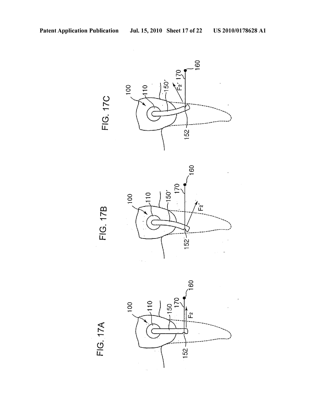 ORTHODONTIC DEVICE AND ORTHODONTIC METHOD - diagram, schematic, and image 18