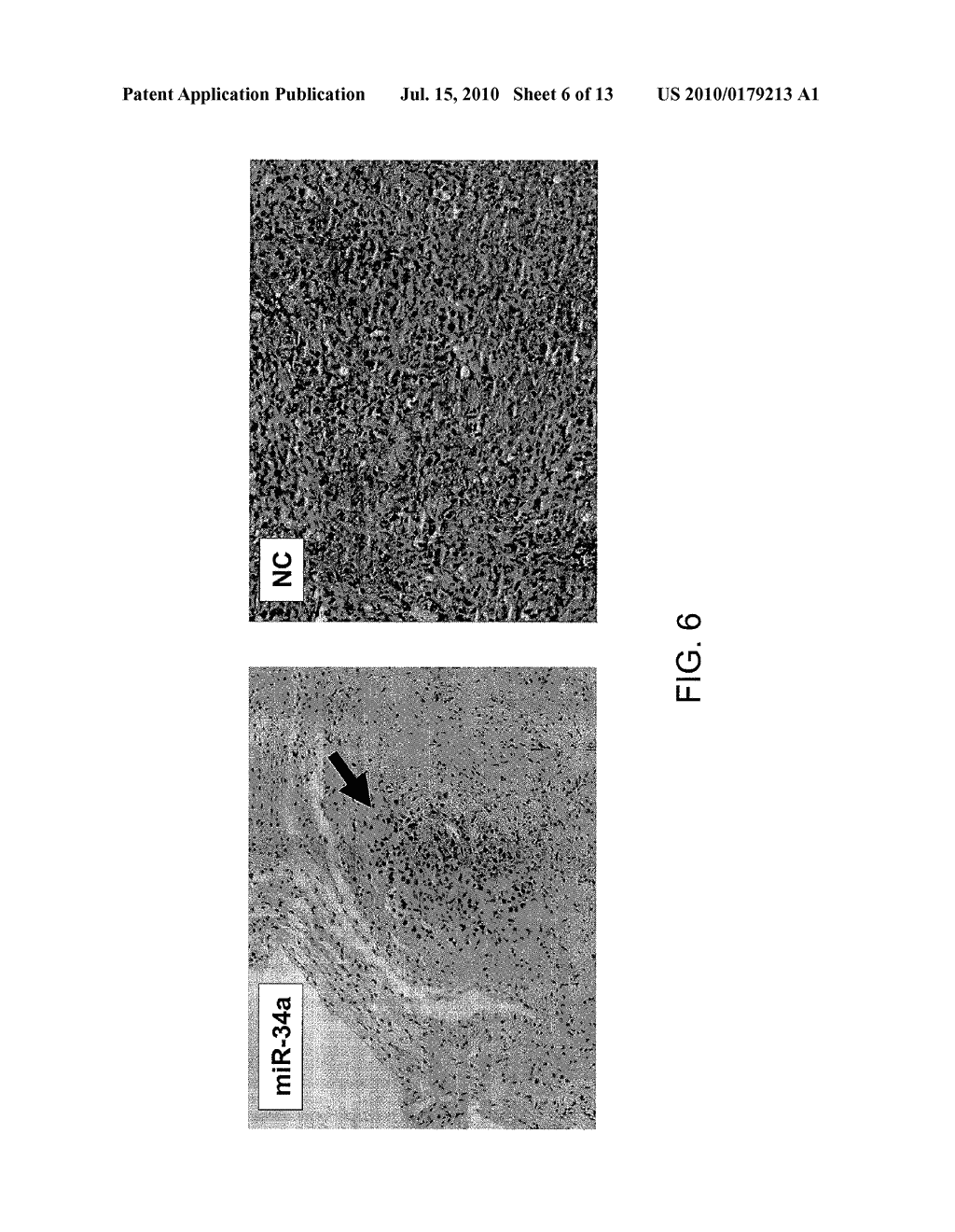 Methods and Compositions Involving miRNAs In Cancer Stem Cells - diagram, schematic, and image 07