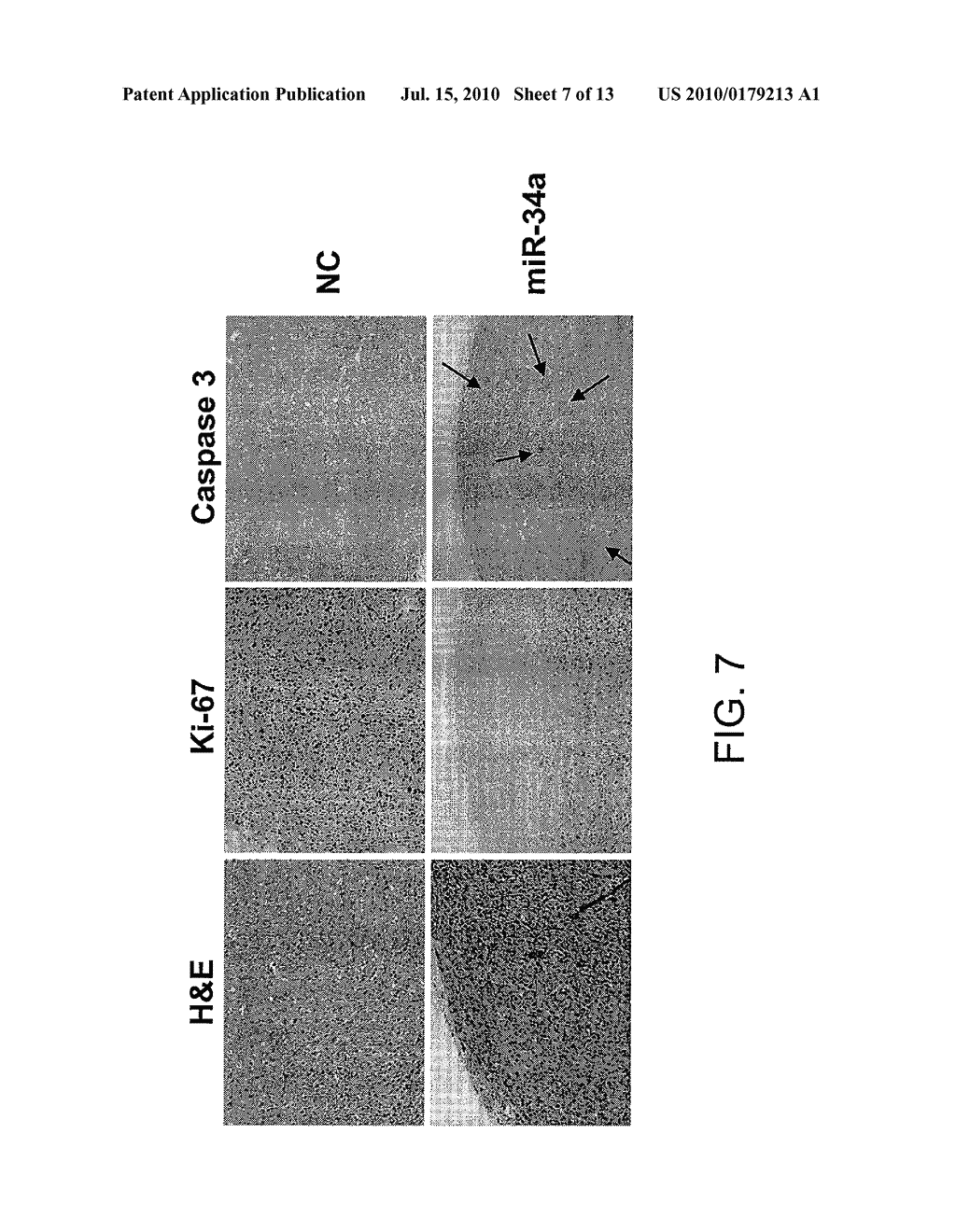 Methods and Compositions Involving miRNAs In Cancer Stem Cells - diagram, schematic, and image 08