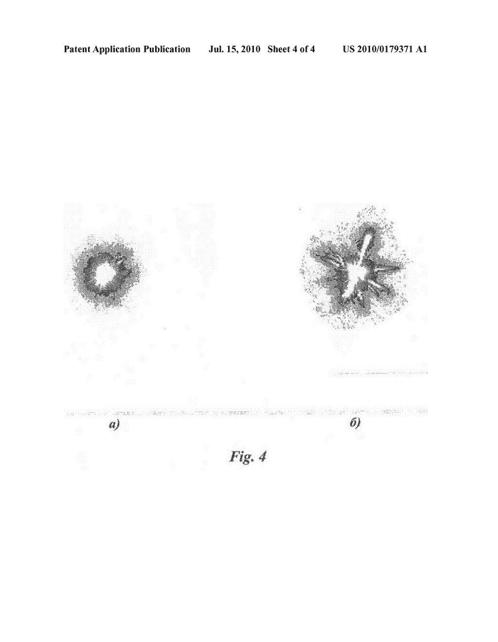 METHOD FOR HYDROMAGNETOTHERAPY (VARIANTS) AND DEVICE FOR REALIZING THE METHOD - diagram, schematic, and image 05