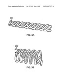 Method of enhancing skin appearance through the combination of Titan TM and TMR methods diagram and image