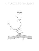 BODY-INSERTABLE APPARATUS SYSTEM diagram and image