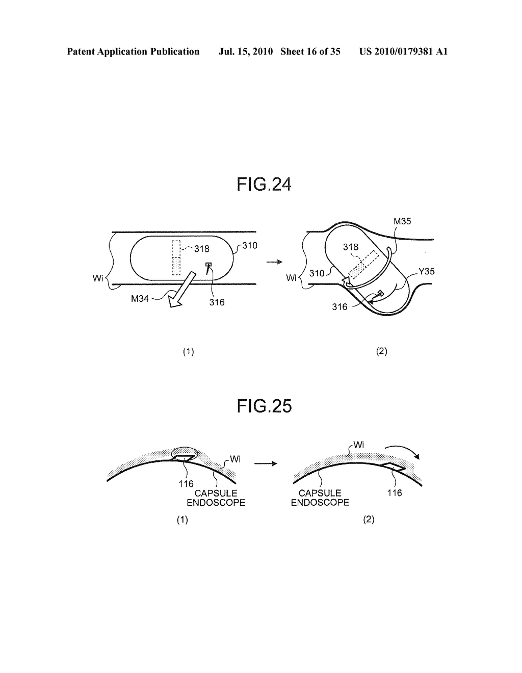 BODY-INSERTABLE APPARATUS SYSTEM - diagram, schematic, and image 17