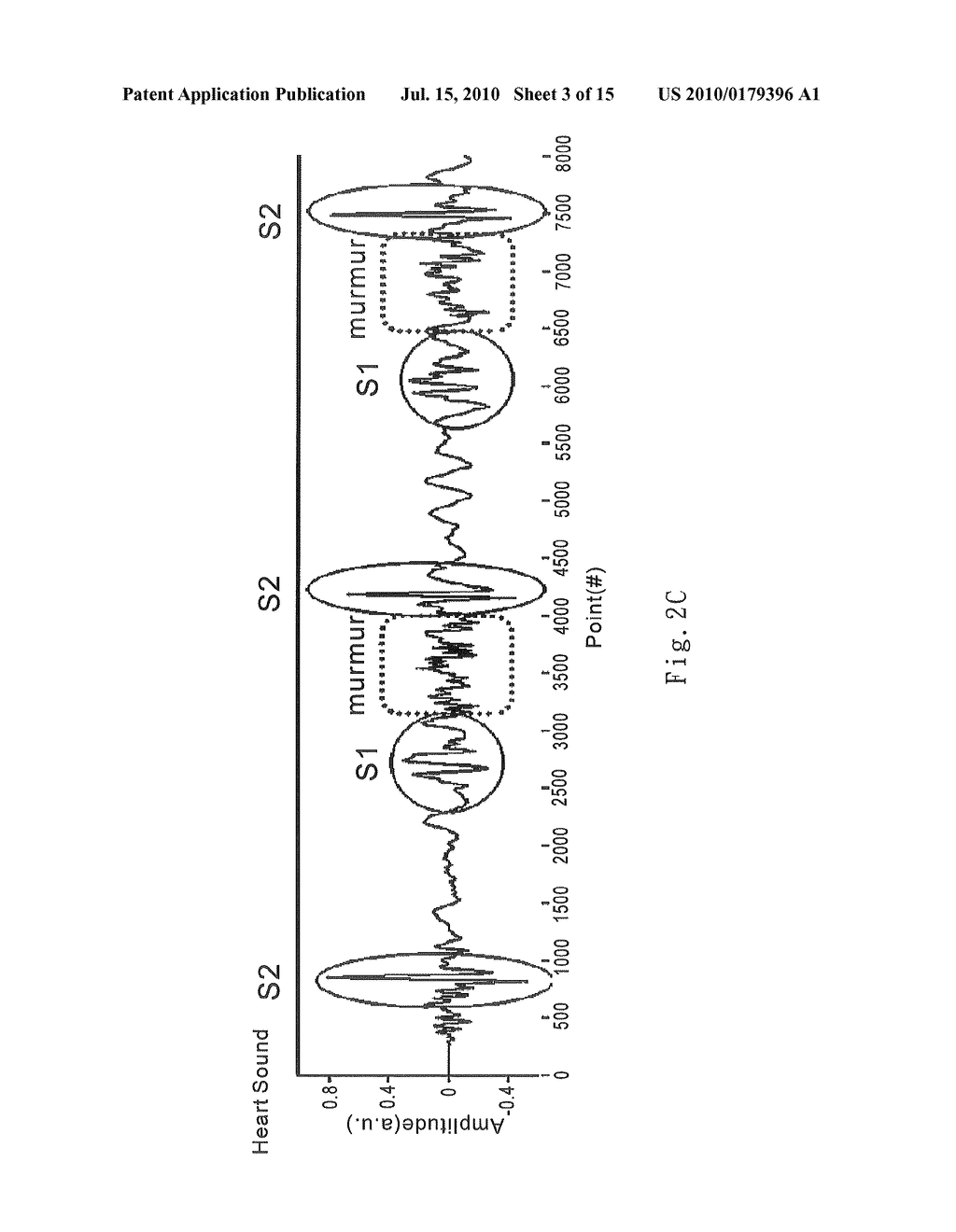 RAPID METHOD FOR ANALYZING BIO-SIGNAL INSTANTANEOUSLY BY PHASE SPACE COMPLEXITY DIFFERENCE AND ITS DEVICE - diagram, schematic, and image 04