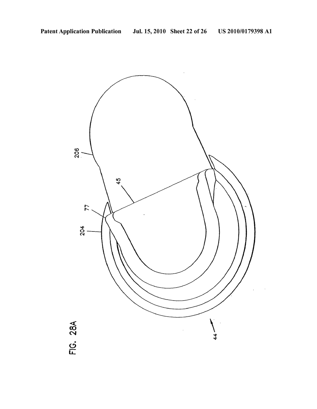 Analyte Monitoring Device and Methods of Use - diagram, schematic, and image 23