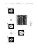 MODEL-BASED DIFFERENTIAL DIAGNOSIS OF DEMENTIA AND INTERACTIVE SETTING OF LEVEL OF SIGNIFICANCE diagram and image