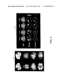 MODEL-BASED DIFFERENTIAL DIAGNOSIS OF DEMENTIA AND INTERACTIVE SETTING OF LEVEL OF SIGNIFICANCE diagram and image