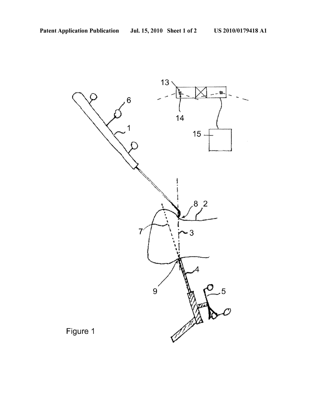 INSTRUMENT ALIGNING METHOD USING A FREE REFERENCE - diagram, schematic, and image 02