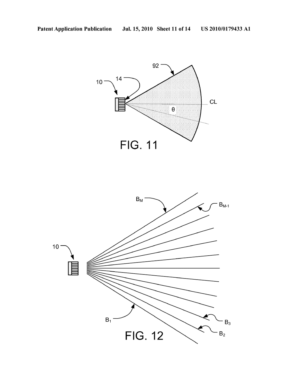 TRANSESOPHAGEAL ULTRASOUND USING A NARROW PROBE - diagram, schematic, and image 12