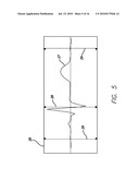 DEVICE AND PROCEDURE FOR VISUAL THREE-DIMENSIONAL PRESENTATION OF ECG DATA diagram and image