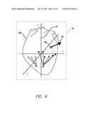 DEVICE AND PROCEDURE FOR VISUAL THREE-DIMENSIONAL PRESENTATION OF ECG DATA diagram and image