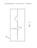 DEVICE AND PROCEDURE FOR VISUAL THREE-DIMENSIONAL PRESENTATION OF ECG DATA diagram and image