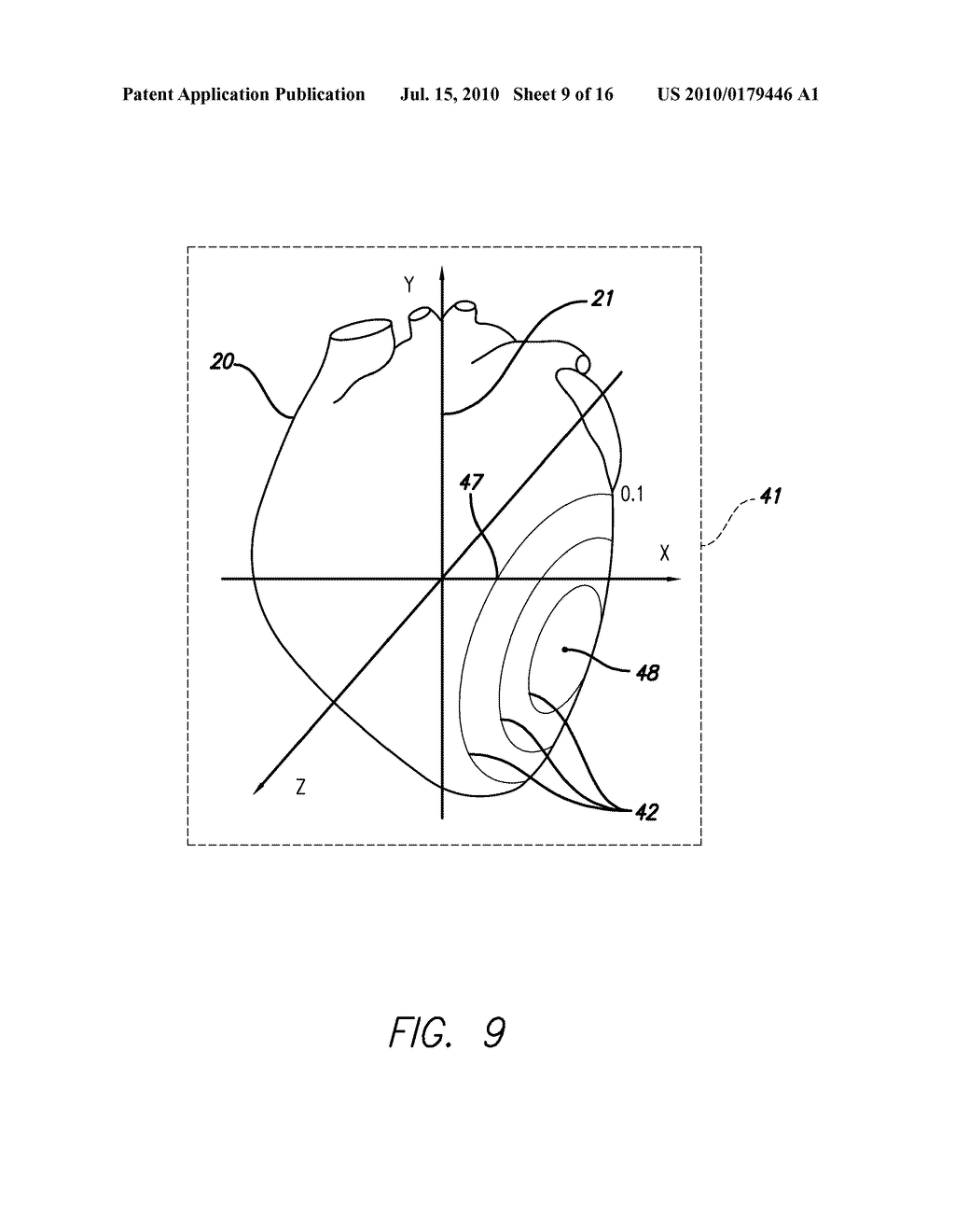 DEVICE AND PROCEDURE FOR VISUAL THREE-DIMENSIONAL PRESENTATION OF ECG DATA - diagram, schematic, and image 10