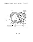 DEVICE AND PROCEDURE FOR VISUAL THREE-DIMENSIONAL PRESENTATION OF ECG DATA diagram and image