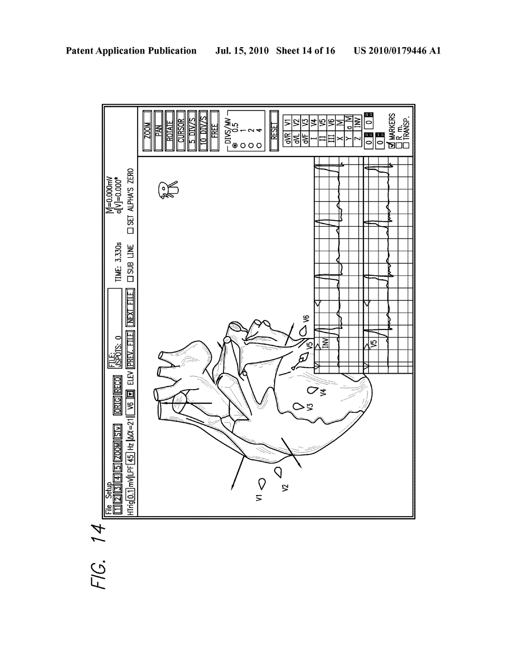 DEVICE AND PROCEDURE FOR VISUAL THREE-DIMENSIONAL PRESENTATION OF ECG DATA - diagram, schematic, and image 15