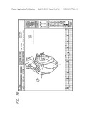 DEVICE AND PROCEDURE FOR VISUAL THREE-DIMENSIONAL PRESENTATION OF ECG DATA diagram and image