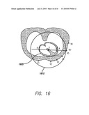 DEVICE AND PROCEDURE FOR VISUAL THREE-DIMENSIONAL PRESENTATION OF ECG DATA diagram and image